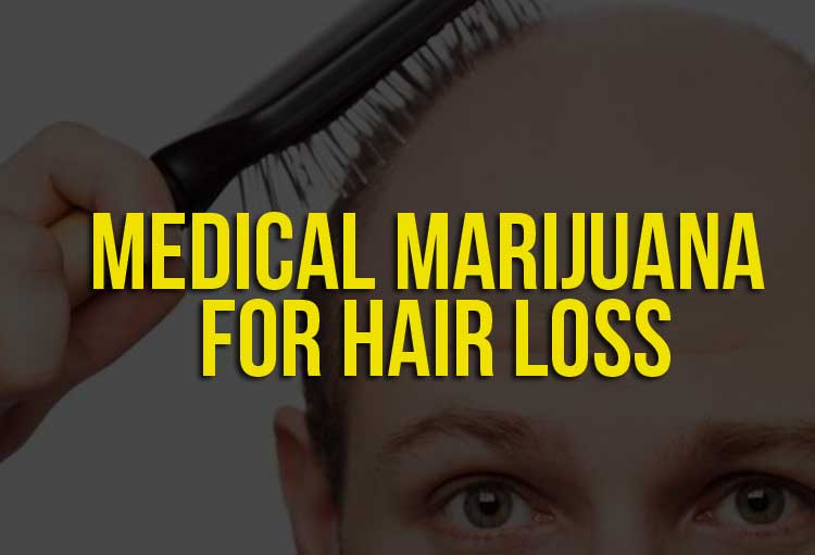 Medical Marijuana for Hair Loss
