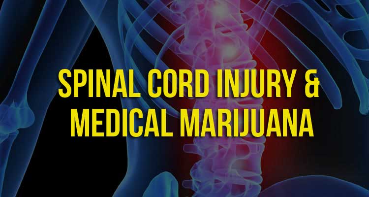 Cannabis for Spinal Cord Injuries